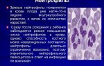 Палочкоядерные нейтрофилы: норма в крови, причины повышения и понижения