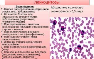 Абсолютное содержание эозинофилов и причины нарушений абсолютного числа эозинофилов в крови