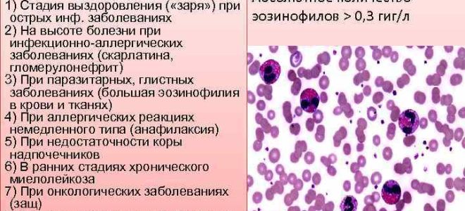 Анализ крови на вирусы: показатели при вирусной инфекции
