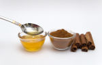 Мёд и корица от холестерина: рецепты для “чистки сосудов” и хорошего самочувствия
